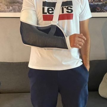 Kako će sad udarati pečate: Ministar Aladrović slomio ruku