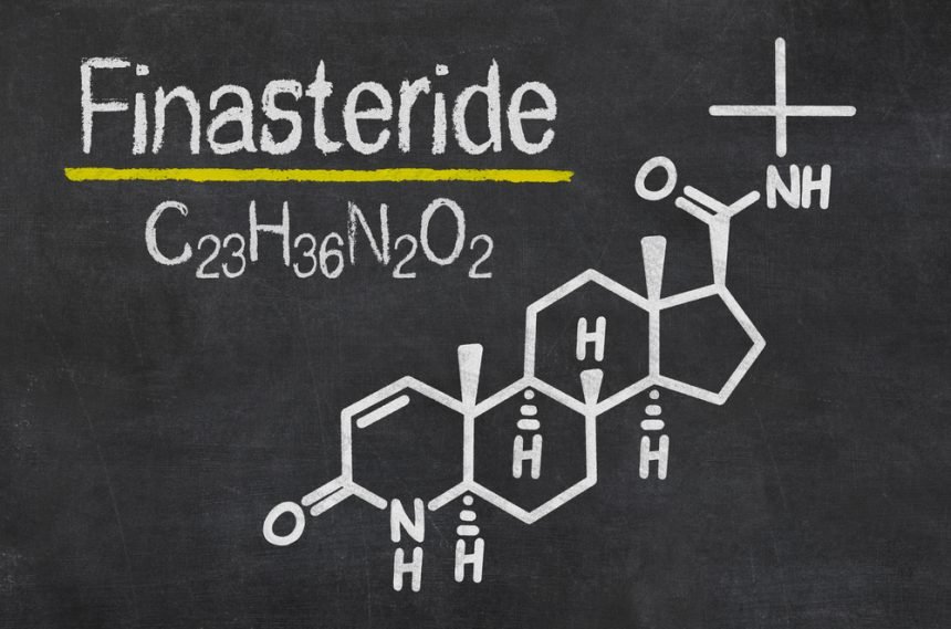 Finasterid tablete – prednosti i nuspojave