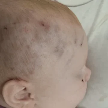 Sjećate li se fotografije ozlijeđene petnaestomjesečne bebe: Inspekcija je sada utvrdila nevjerojatan prijestup