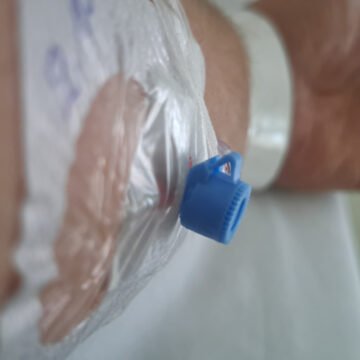 Zašto mladi ljudi sve češće obolijevaju od raka pluća: Posebno zabrinjava jedna pojava